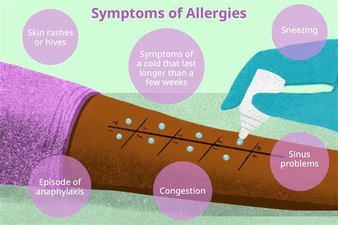 blood test for allergy skin